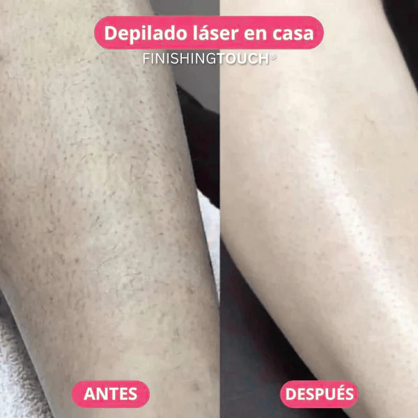 Depiladora Láser Corporal 2 en 1 😍