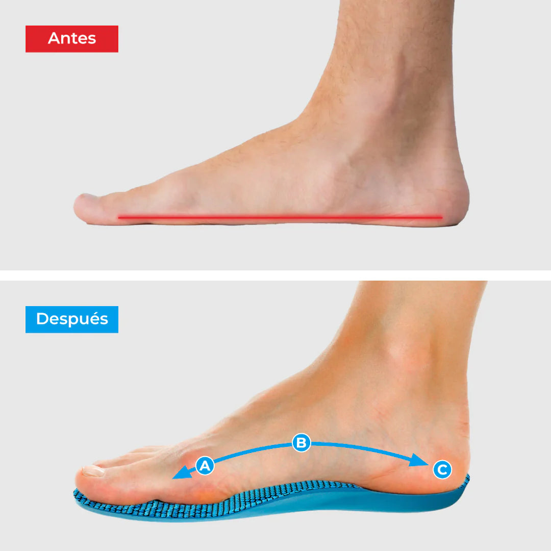 Plantillas ComfyFeet - Disfruta de días sin dolor, sin tratamientos caros ni visitas al médico....