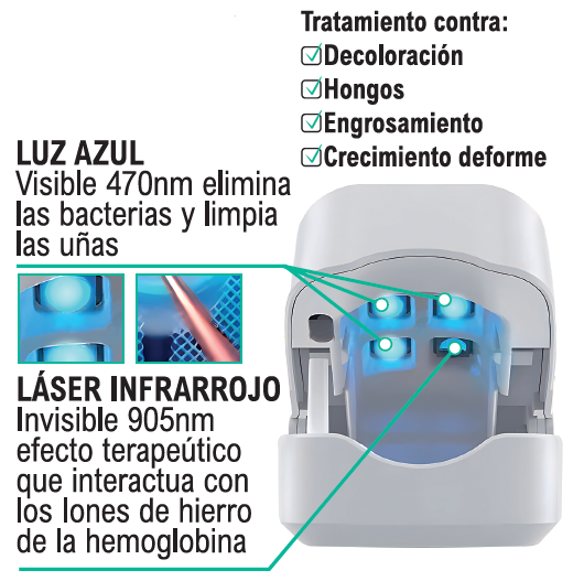 Láser antifúngico para uñas – Elimina los hongos de forma rápida y eficaz